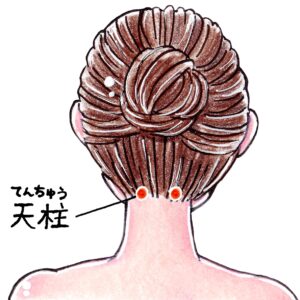 調布 整骨院 クーラー病 冷房病 天柱 沖縄